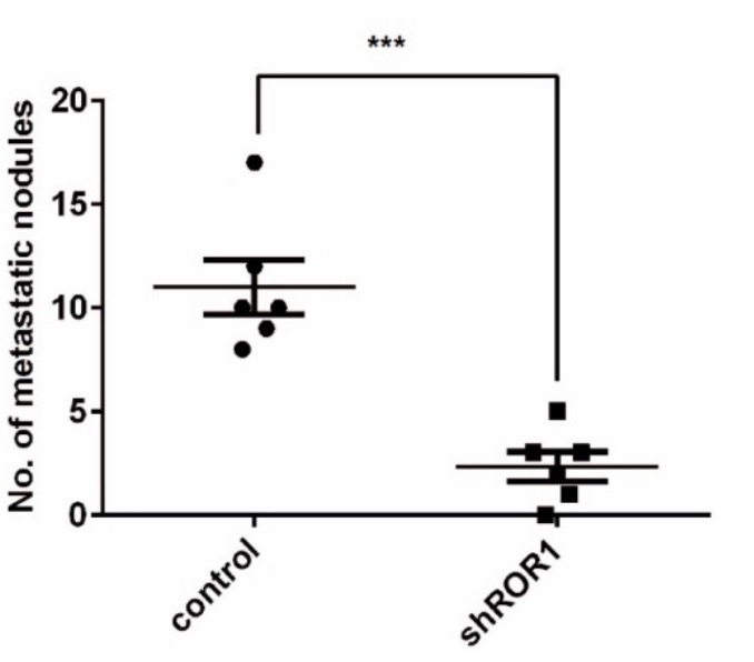 prevents metastasis and prolongs survival (Obradevic et al 2019, Nature)