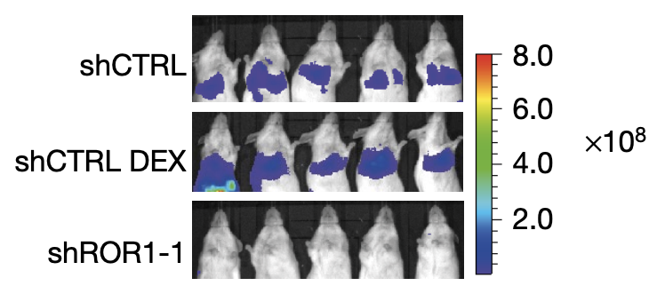 prevents metastasis and prolongs survival (Obradevic et al 2019, Nature)