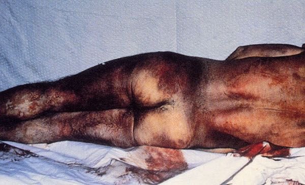 Arnaldo Otegi 🔻 tweet media