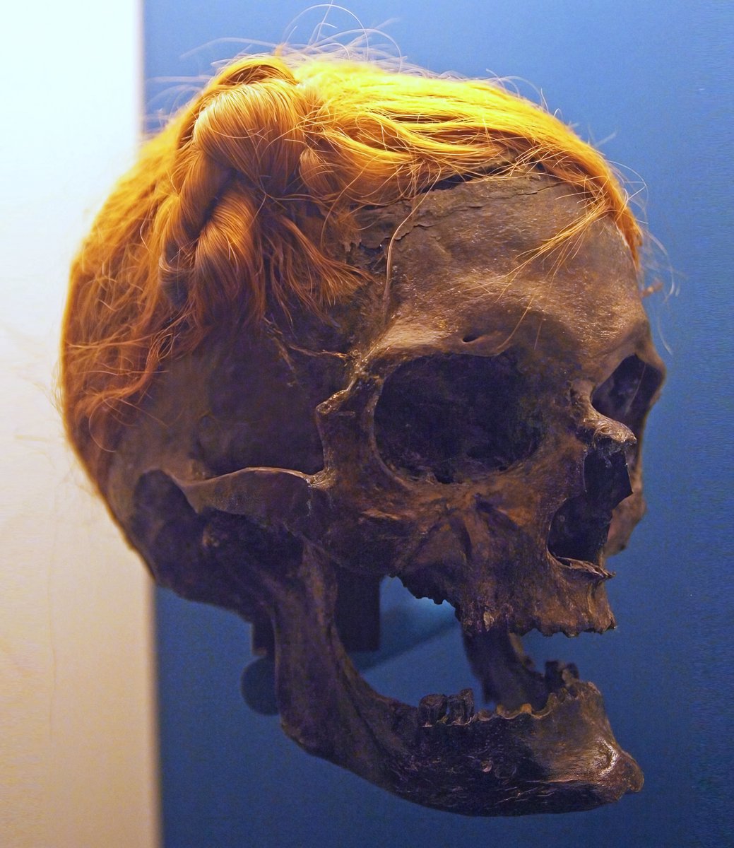 The head of the 'Osterby Man', a Germanic warrior of the Suebi who died around 100 AD. He was struck by a blunt object before being decapitated and his head thrown into a bog. His hair has been perfectly preserved, tied in the distinctive Suebian knot worn by men of his tribe.