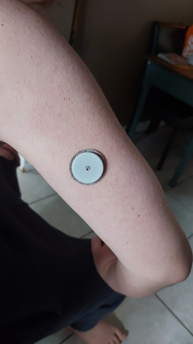 InkedDeviant's tweet photo. Libre Sensor Changing Day. Defs NOT Nicks Favorite.
Anyone Have Tips To Make It Easier To Remove The Old One?
The Outside Is Less Sticky At Day 14, But Around The Needle Isn't😔
#diabetes #Autism #type1diabetes #autismacceptance #libre #libresensor #DiabetesEducation #momlife https://t.co/HKwWw7svZn