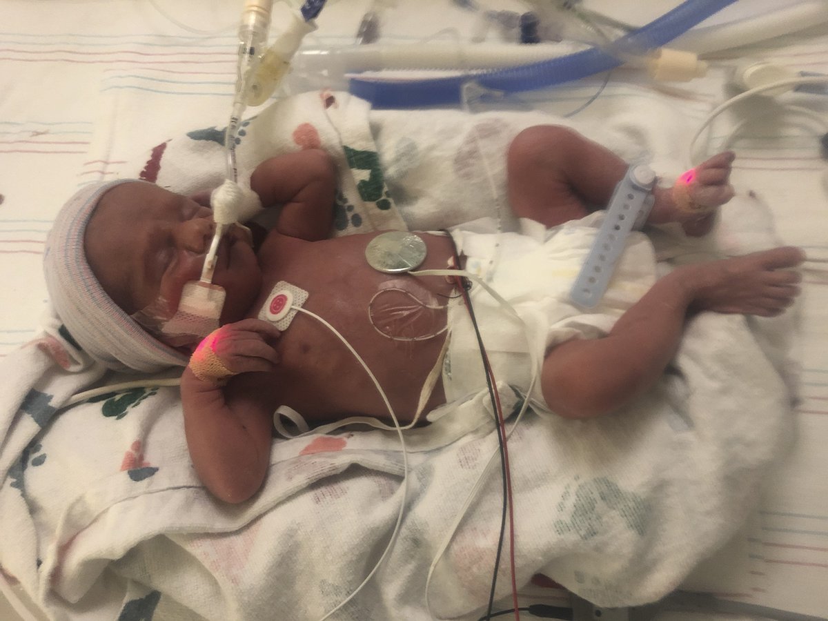 At this time a member of our Skyhawk family needs our help. If you have the time and feel so inclined, please consider supporting <a href="/UTM_FOOTBALL/">UT Martin Football</a> assistant coach Sean Fisher's son Beau and his rising medical costs. 

Together we are #SkyhawkStrong 
bit.ly/2Z9MSNU