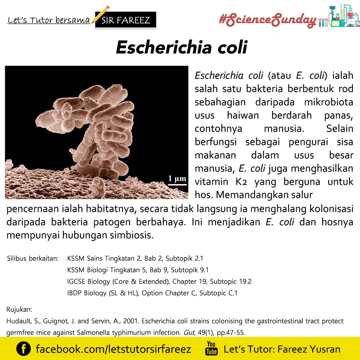 Fareez_Yusran's tweet photo. #ScienceSunday
Pernah dengar bakteria bernama E. coli? E. coli sebenarnya ialah salah satu mikroorganisma yang menjadikan usus kita sebagai habitatnya!
#SainsTingkatan2 #ScienceForm2 #KSSM #LetsTutorSirFareez https://t.co/DSOhR2vI9h