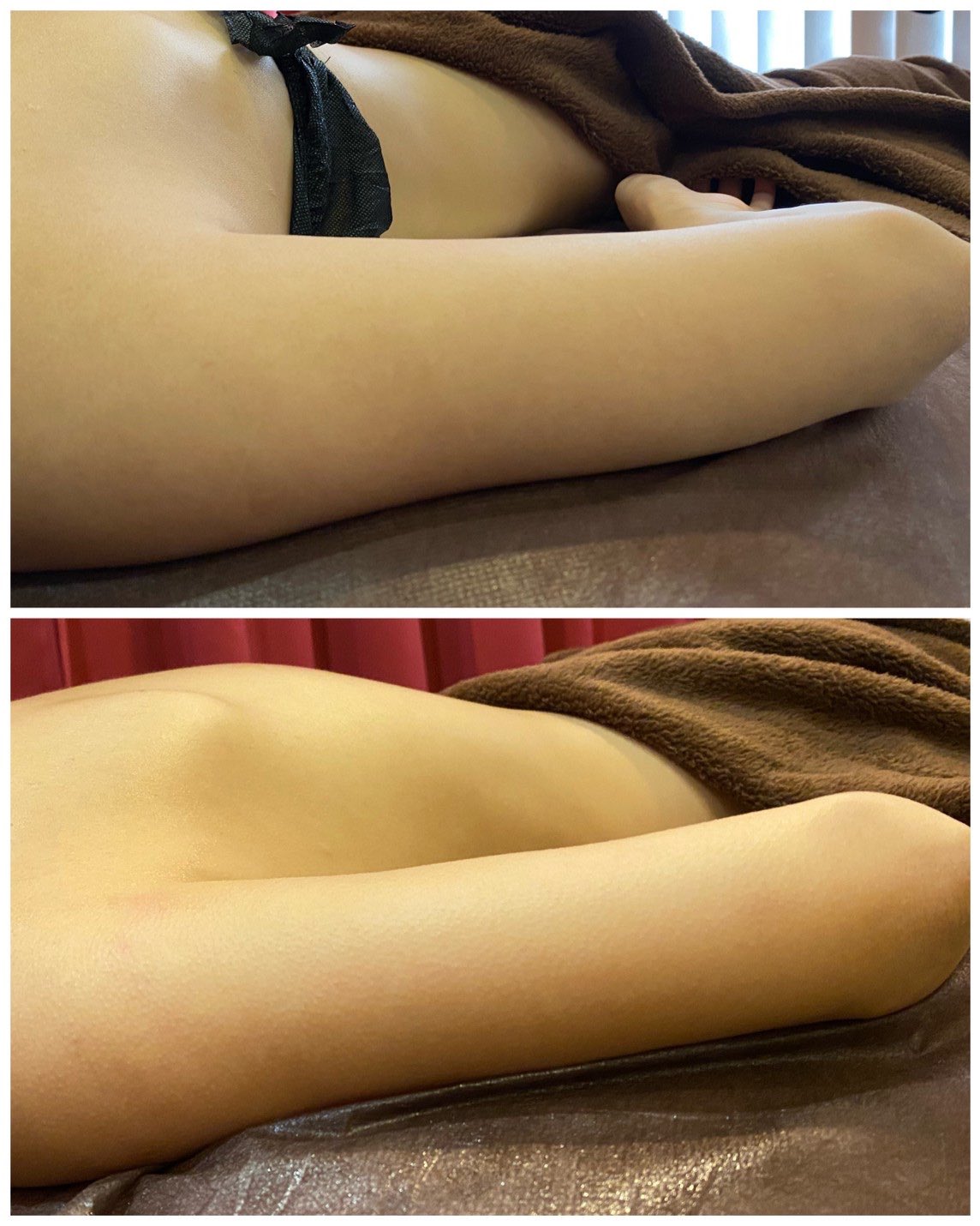 ナージュクリニカルサロン على تويتر 痩せにくい二の腕も ナージュにお任せ下さい ナージュ ナージュクリニカルサロン 名古屋エステ 二の腕痩せ ハイフ Hifu ボディーハイフ ダイエット 痩身 痩身エステ T Co P30iyfnrul تويتر