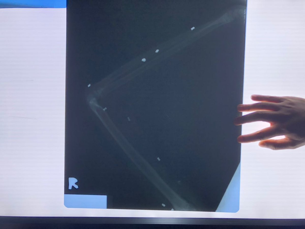 surface pro 3 phantom touch surface pro 3 phantom touch