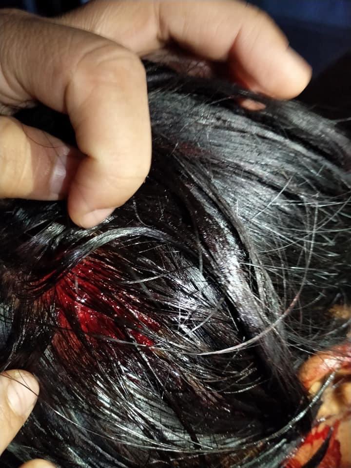 MinThan16901630's tweet image. Myanmar Military raid at night. Threw to public with tear bomb and create chaos and violence #WhatsHappeninglnMyanmar