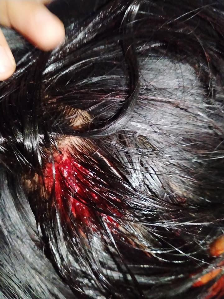 MinThan16901630's tweet image. Myanmar Military raid at night. Threw to public with tear bomb and create chaos and violence #WhatsHappeninglnMyanmar