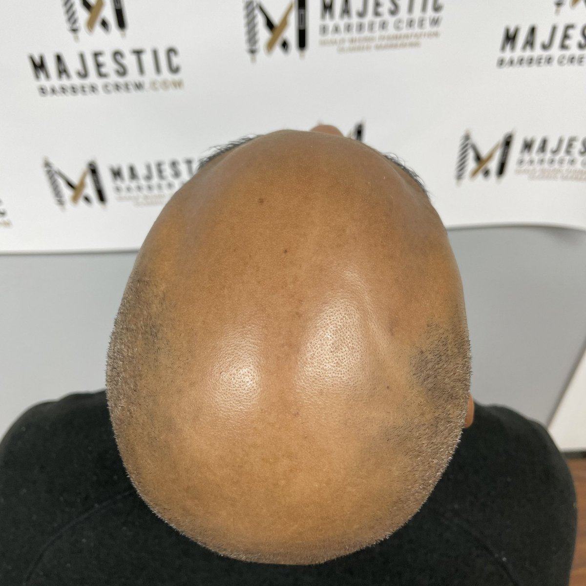 jaimethebarber's tweet photo. Scalp Micro Pigmentation (SMP) a great solution for hair loss. Message me or go to my website to schedule a consultation @ majesticbarbercrew.con https://t.co/zYeWCxwKij