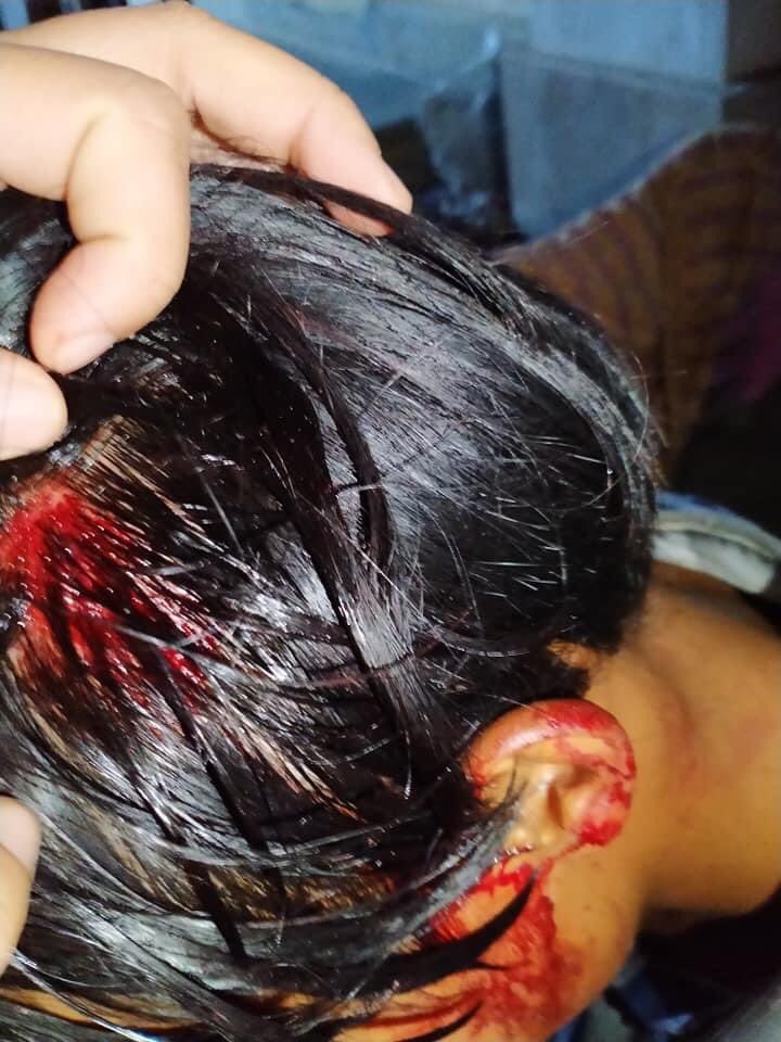 TW/ Blood 
You will be paid back for what you did military. 
We do not have any weapon to fight back. 
Do we have to sacrifice our lives? 
 Please help us 

JUNTA STARTS VIOLENCE
 <a href="/UNHumanRights/">UN Human Rights</a>
#Feb14Coup 
#WhatsHappeningInMyanmar