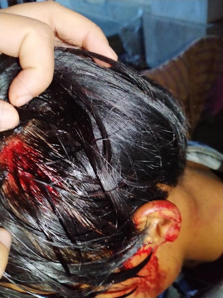 HsuHtet07's tweet photo. In Myitkyina, journalists are arrested by Myanmar Military and unarmed local citizens were shooted with gun and tear gases by the military. Our citizens lives are not safe.
JUNTA STARTS VIOLENCE 
TW:blood and violence 
#Feb14Coup 
#WhatsHappeningInMyanmar https://t.co/1Uh9tuWSHh