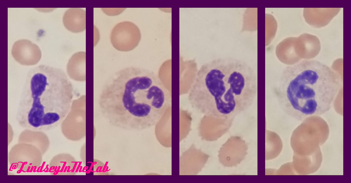 Happy Valentine's Day! We definitely all need a little #Love and #Kindness right now, so spread the love! But keep your #germs to yourself. #MedLabTwitter #ClinLab #Lab4Life #IamASCLS #WeSaveLivesEveryday #WashYourHands #AndBeSafe ❤️💘💋🌹💝