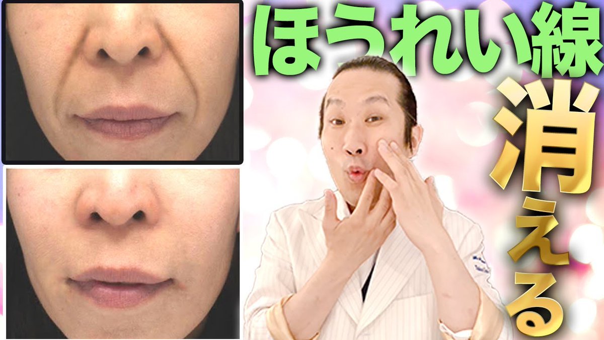 ほうれい線消す
