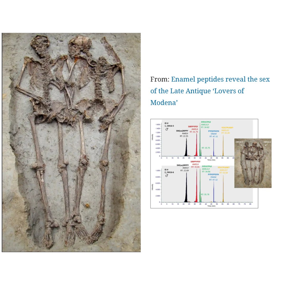 BonesLabUnibo's tweet photo. Enamel peptides reveal the sex of the Late Antique "Lovers of Modena"
https://t.co/5wW07EgvXY https://t.co/31rOdPE0Wq