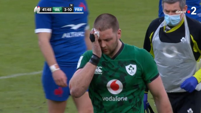cheztontontlse's tweet photo. - Quand ton pote t'a dit: '"Vas-y pète un glaçon avec ton front ça risque rien."

#IRLFRA 🔵⚪🔴 https://t.co/EAEijcKLOn