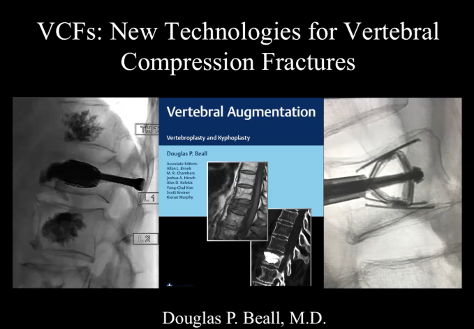 Had the honor of moderating for <a href="/dougbeall/">Douglas Beall</a> during #WCVIR. What a powerhouse for Spinal Interventions! #irad #TwittIR