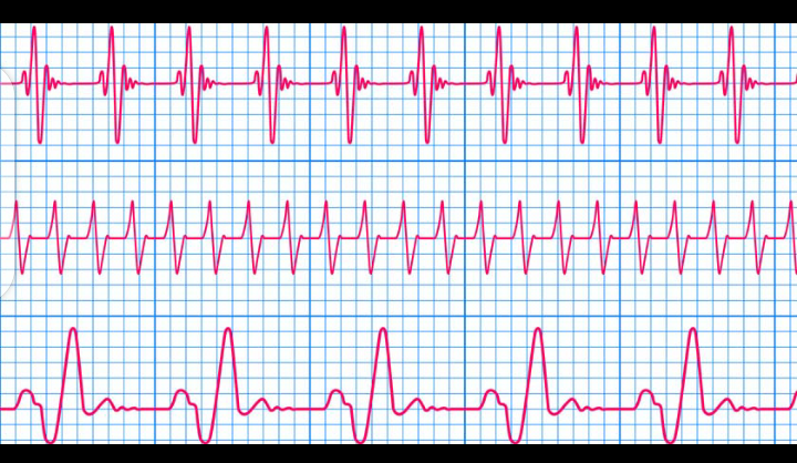 PNoundjo's tweet photo. La vie est un comme un électrocardiogramme y'a des hauts et des bas !! Et c'est l'ensemble de tous ces variations qui montre que nous somme en vie !
#NPC #Baolé #Tchoumi https://t.co/HFHhy1dPQT