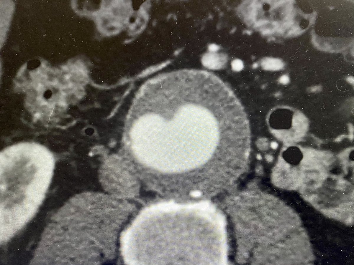 Bill Beckerman tweet media