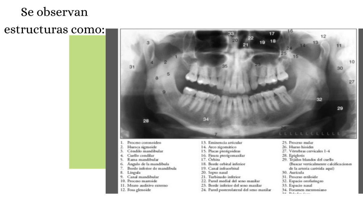 MariaFe44191922's tweet photo. #Radiografiasextraorales
Cirugia I 
@MariselaPonce7 https://t.co/lUFMqScZAQ