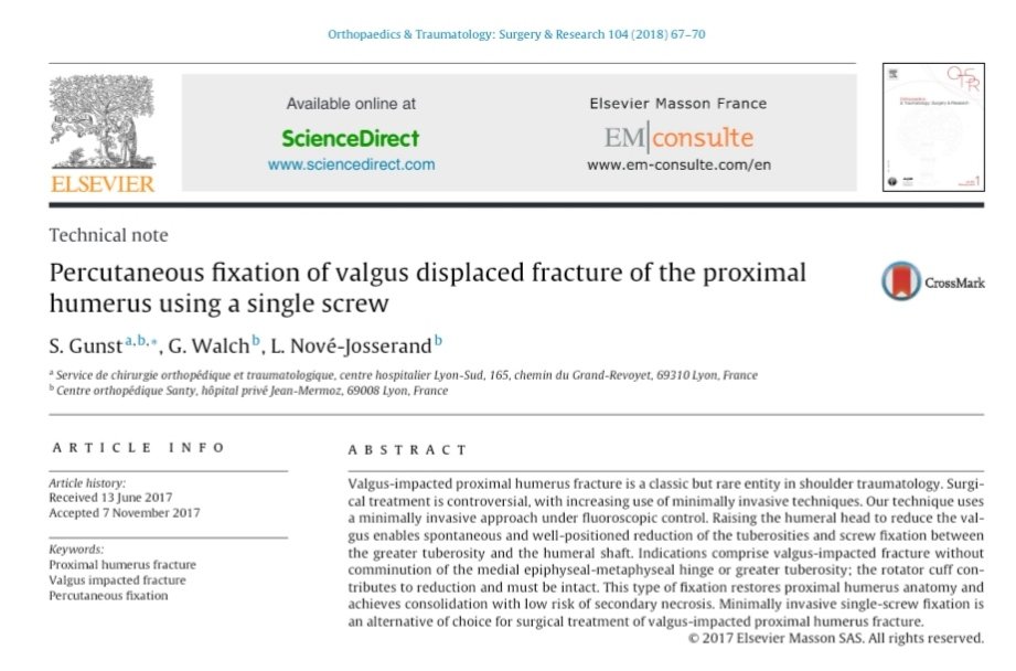 🗞️ Nota técnica
🗜️Tip: Qué os parece esta técnica percutánea para algunas fracturas en valgo? Tiene sentido ya que suelen ser autoestables tras reducción. Si lo recomienda Gilles Walch no debe ser malo. 
Open acces
sciencedirect.com/science/articl…