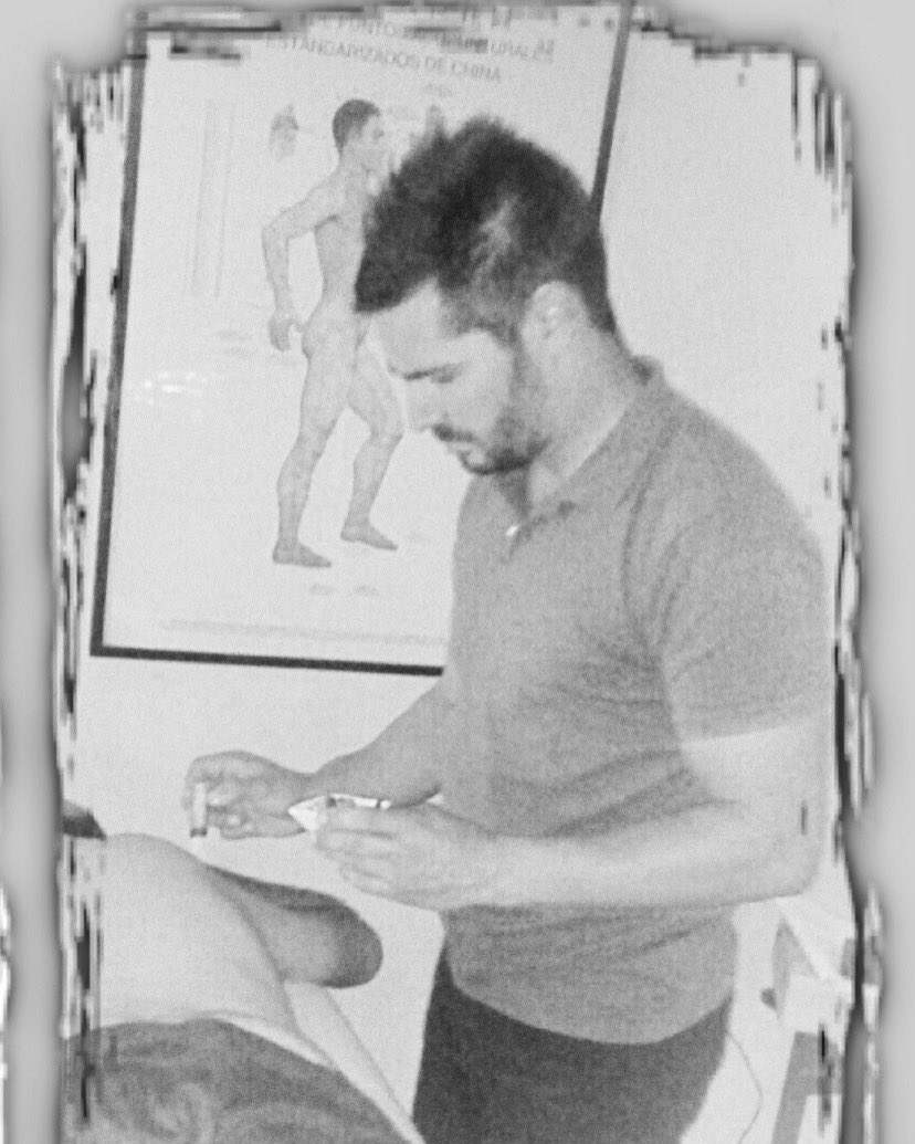 olimpomasajes's tweet photo. Terapias naturales. Moxibustion 
#olimpo #olimpomasaje #quiromasajedeportivo #quiromasajeolimpo #olimpomasajedeportivo https://t.co/s2LoIx8cRk