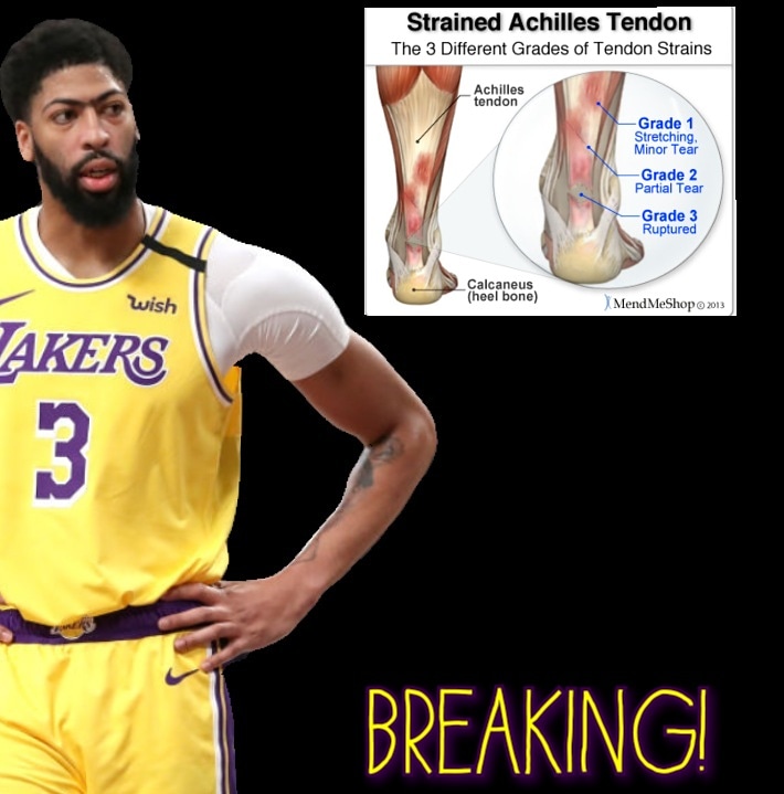 LegacyMakerSPN's tweet image. #breakingnews @robb_johnson_media_ report for the @legacymakersports 
@antdavis23 has a #strained #achillies he will have a #mri to see the severity of the injury. 
#lakers 
#lakersnation #lakers4life #losangeles #lakeshow #anthonydavis #lebronjames #nba #breakingnews🚨