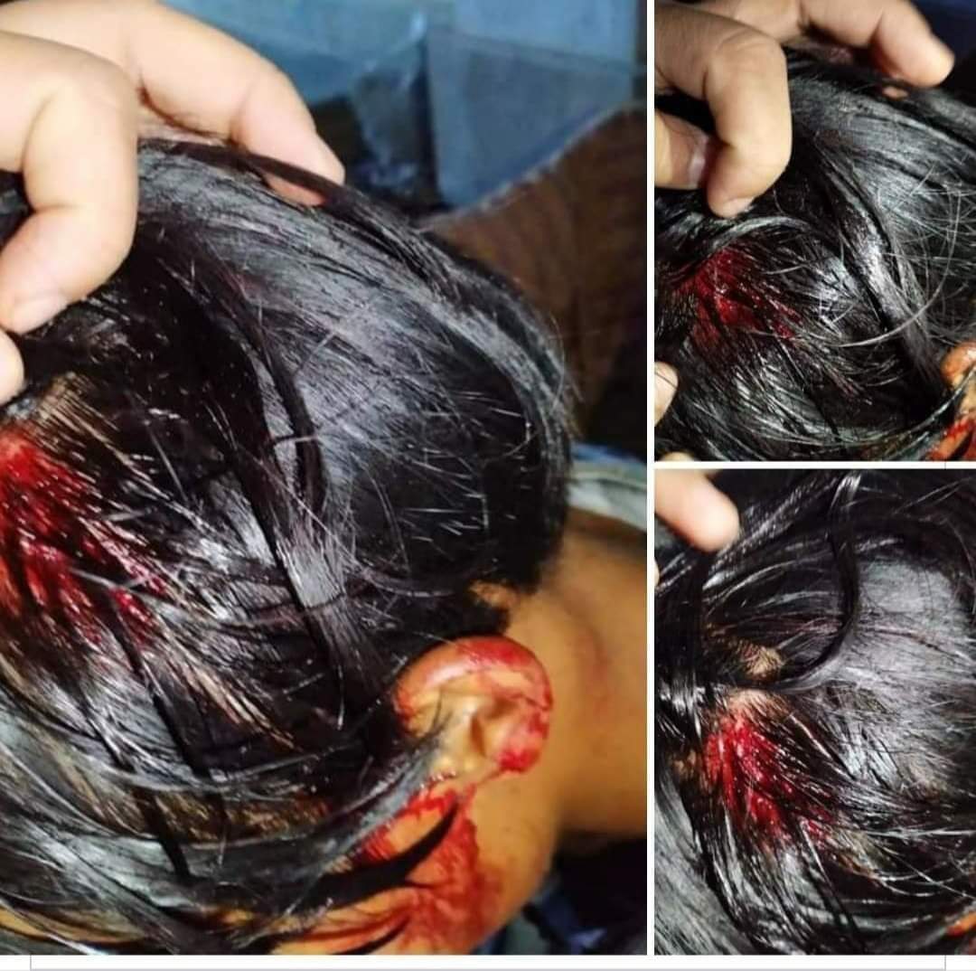 HtetNau54086849's tweet photo. Myanmar https://t.co/EAXVeyG7Ma