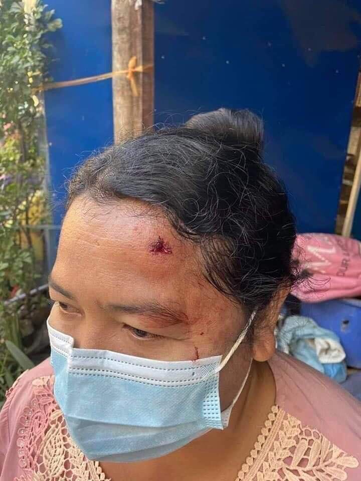Pencilo4's tweet photo. Man in the plain cloth, appears to be a police, is aimed and shot residential area using BB high-pressure gun 10-15  barring, Mandalay, Myanmar. 

WE ARE NOT SAFE 
#Feb15Coup
#WhatsHappeningInMyanmar https://t.co/civnV4YWeU