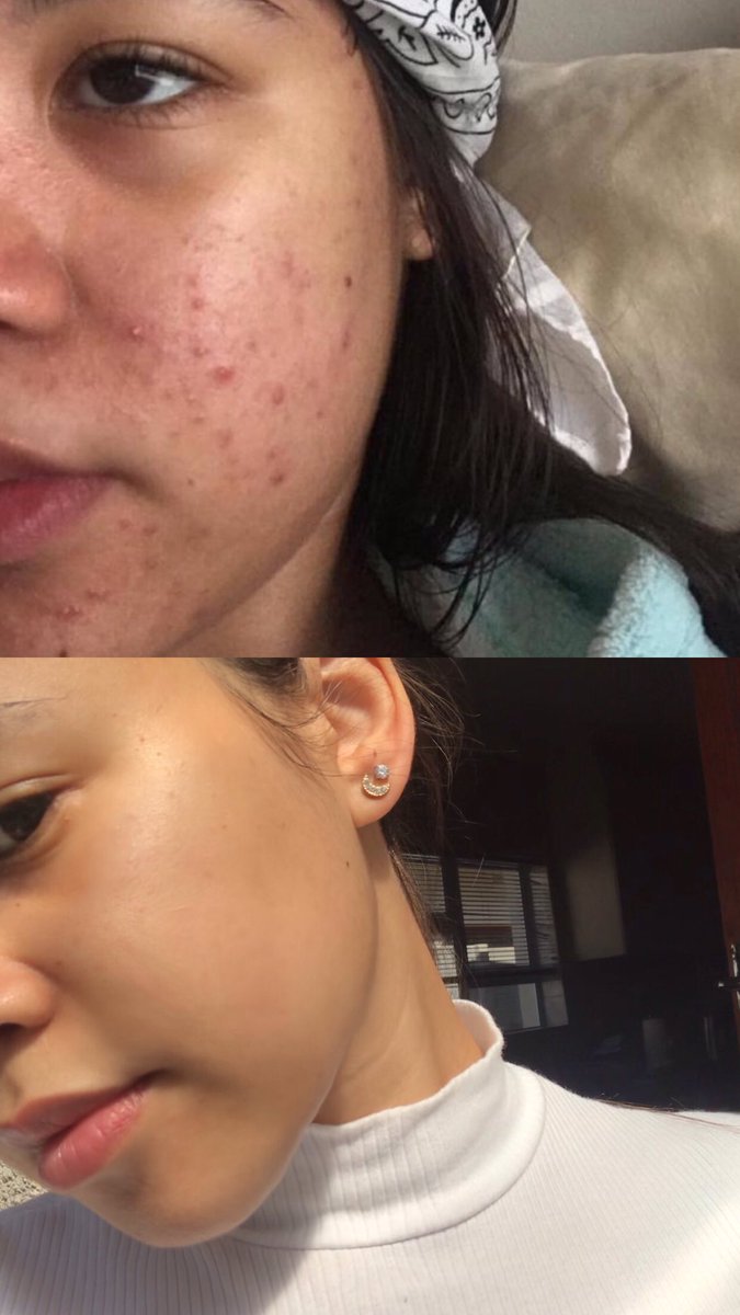 k.blakeley 🍦 tweet media