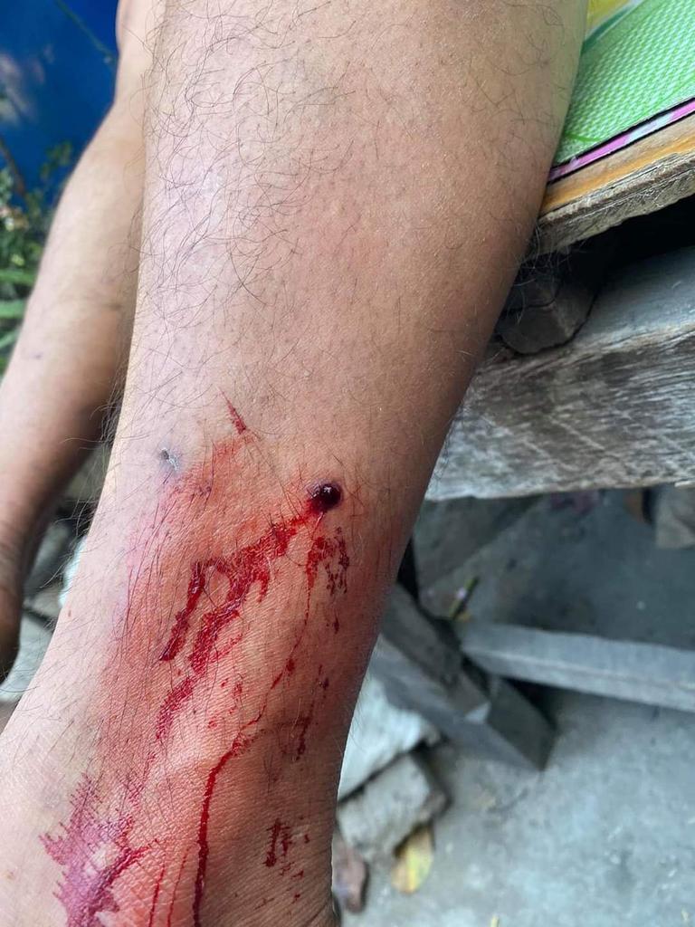 KyawZinitzU's tweet photo. @UN_HRC @UNHumanRights @UN_SPExperts @OHCHRAsia WE ARE NOT SAFE

Police shot and arrested people protesting peacefully in front of Mandalay Economic Bank this evening with rubber bullets as shown in photos.

#Feb15Coup
#WhatsHappeningInMyanmar https://t.co/Z0zBH9funQ