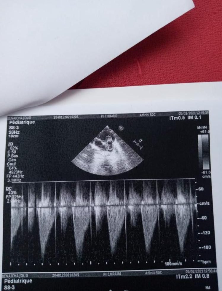 bangchangeI's tweet photo. 🆘 PLEASE RETWEET !!

Joud is the nephew of a friend of mine has a heart problem and needs to get an operation done the 26th of feb, but he lives in Morocco, where the health system is very invalidating for those who don’t have funds
The cost is 13.000€, we managed to get  (1/2) https://t.co/n4Q5GOucUe