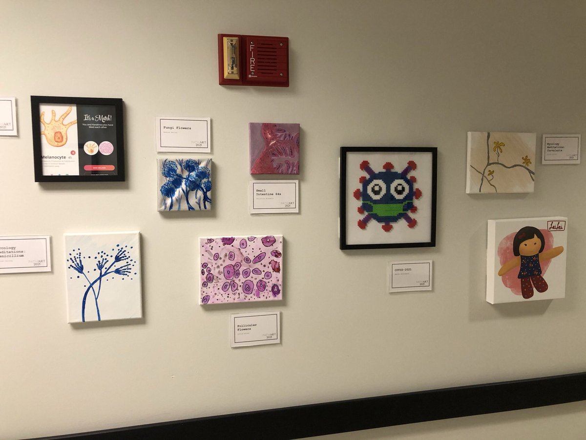 SSOM_SCOPE's tweet photo. It’s opening day for the #pathart21 exhibit at @loyolapathology check out the amazing work from our members of department, their children, the community, and friends from #pathtwitter
Check out the thread below 👇👇 1/3
Cc: @aharrington1884 @eldorado16 https://t.co/aJsS5JUuT8