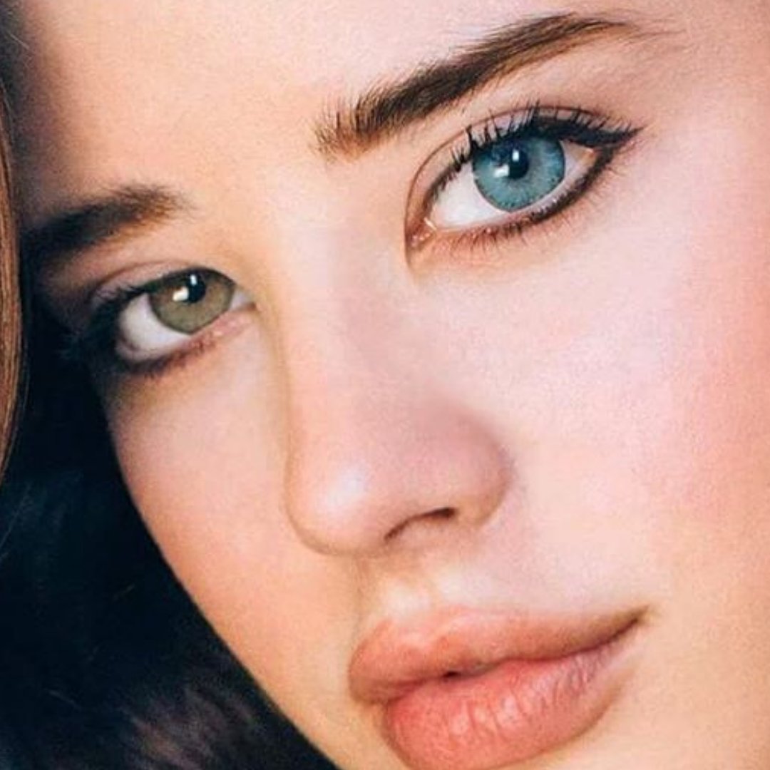 Heard of Heterochromia Iridium? It's a condition in which the colored part  of the eye is multicolored. It may be part of a genetic condition, a  growth, or occur after an eye, image size:1080x1080