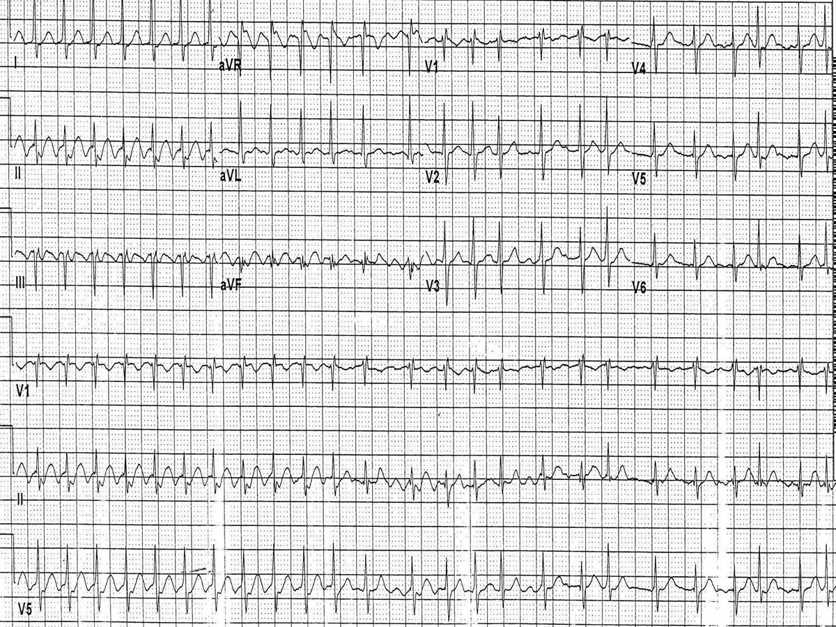 Philip J Podrid MD tweet media