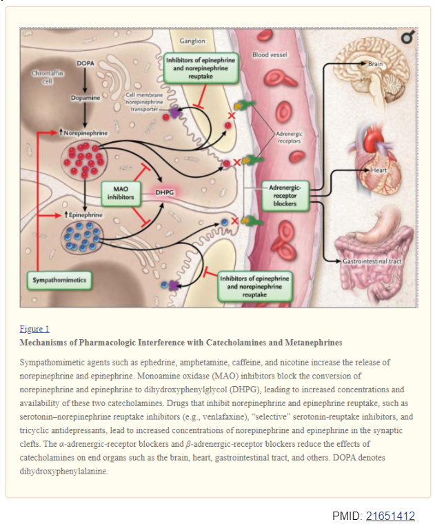 13/ All the aboveSympathomimetics, SSRIs, MAO inhibitors, α/β blockersfalse catecholaminesAcetaminophen interferes w/ liquid chromatographyStop medications ~2 wks prior to testingIf not, Clonidine suppression test (PMID: 21615192, 28752085, 21651412)