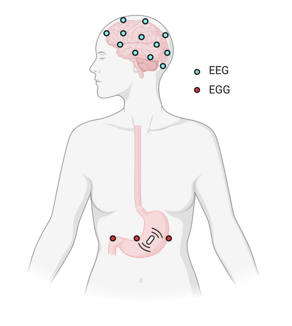Ever wonder how gut feelings get processed in the brain? In our new preprint we found that an ingestible vibrating capsule produced changes in both stomach sensation and gastric-evoked brain activity: biorxiv.org/cgi/content/sh… (1/5)