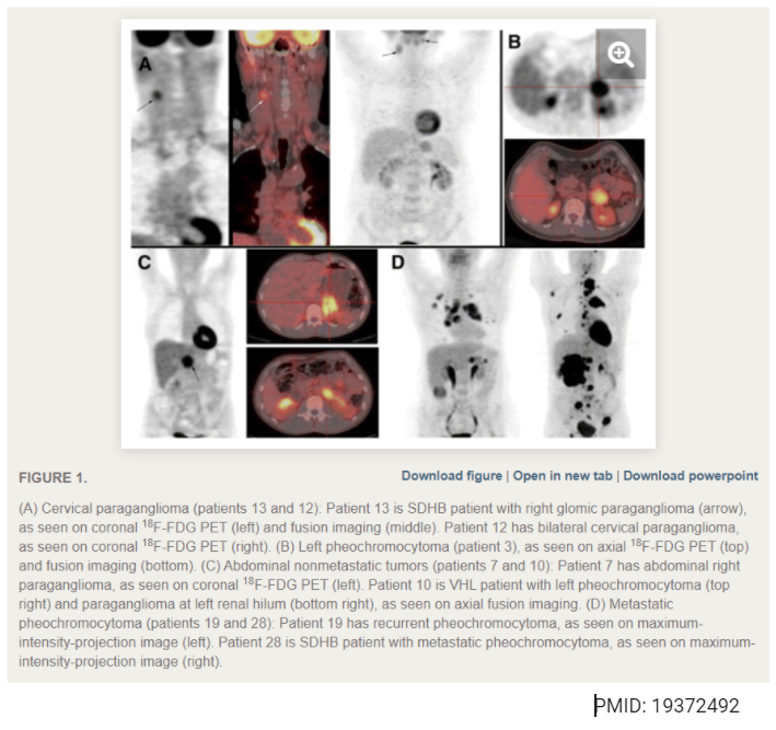 18/ FDG PET:FDG is a glucose analogueUseful in tumours with  glycolytic activityGa68 DOTATATE PET:Somatostatin analogueGood uptake in well-differentiated tumours Sensitivity & Resolution  RadiationPMID: 19372492