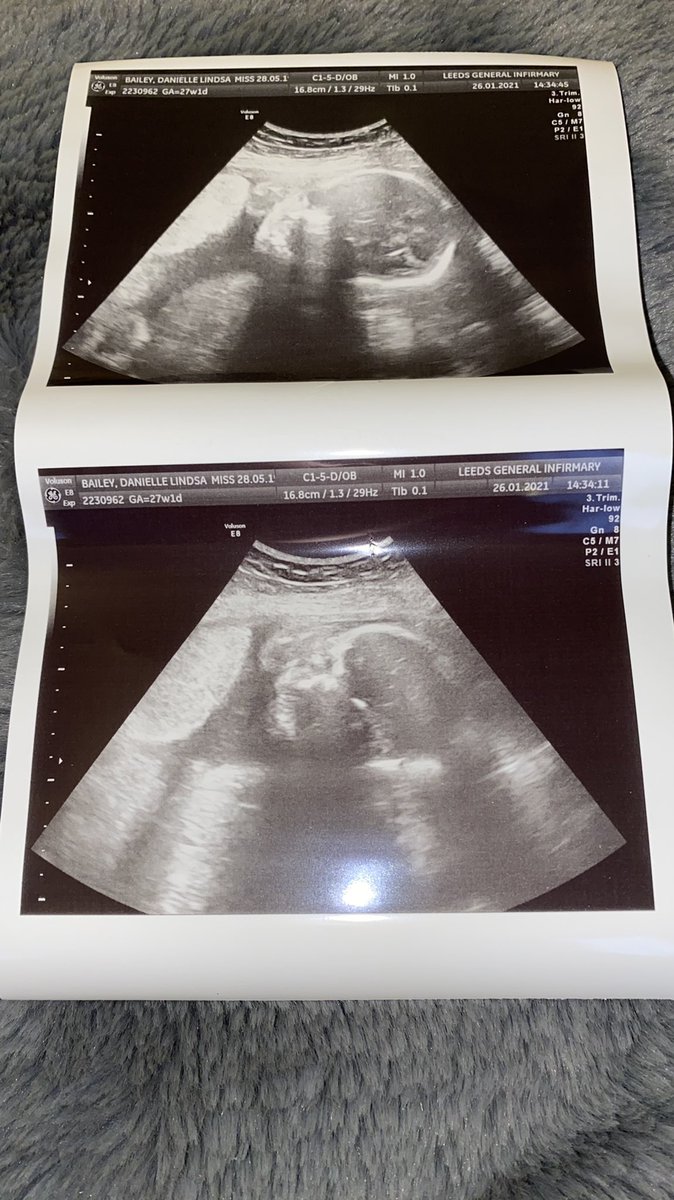 DanieIIe_Bailey's tweet photo. Not long now🥰💙 only 9 weeks and 1 day left until my due date! #pregnancy #pregnantwomen #teddy #boy #son #mummy #mummytobe #april #9weeksleft #Countdown #Baby #babyboy #LoveYou #myworld #cantwait #mumlife #scan https://t.co/sgaS4kFGHu