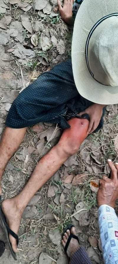 Polices used water cannon ,tear gas and shot gun with real bullet to peaceful protesters who requested to free protesters who are arrested yesterday at MyaungMya.
They also brutally arrested the teachers today.

INHUMAN MILITARY 

#WhatsHappeningInMyanmar 
#Feb16Coup