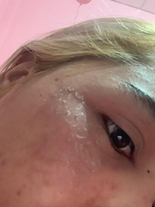 PantipBeauty's tweet image. [CR] แชร์วิธีอยู่กับโรคเซ็บเดิร์ม (Sebderm) หรือผิวหนังอักเสบพร้อมวิธีดูแลรักษาด้วยตัวเอง
pantip.com/topic/40522171

#โรคผิวหนัง #Sebderm #สุขภาพผิว #ผิวแพ้ง่าย #ดูแลผิวหน้า #ความรู้ #สกินแคร์  #ผิวดี #ผิวขาวใส #ครีม #ใช้จริงรีวิวจริง #PANTIP #BeautyPANTIP #โต๊ะเครื่องแป้ง