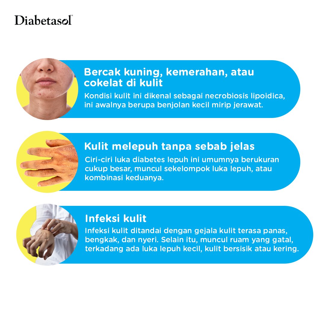Diabetesi dengan lonjakan kadar gula darah yang tinggi perlu mewaspadai adanya luka yang biasanya terjadi di bagian kaki. Berikut beberapa ciri-ciri diabetes dari luka yang muncul di kulit menurut American Academy of Dermatology Association.

#BersamaDiabetasol #JagaGulamu