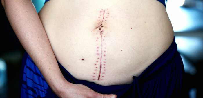 🙌 Los #pacientes quieren recibir una información más completa y comprensible y una mayor participación en varios pasos del proceso perioperatorio lo que podría reducir los temores y el estrés/ansiedad 🙌

Conclusión de una investigación sobre cirugía
 ow.ly/pwBg50DxEmc