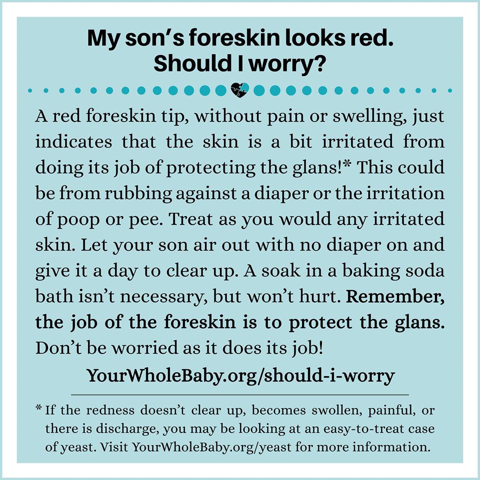 Most of the time red foreskin is pretty normal. It just means that it’s protecting the glans and is a little irritated. A warm baking soda bath and some diaper free time should clear it right up! 

#IntactCare #BabyCare #Parenting #HealthyBabies #YourWholeBaby