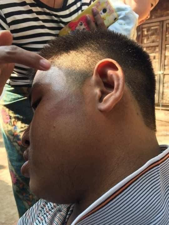 Myanmar Polices and Soldiers hit a 16 years old Cerebral palsy in Mandalay this morning! #WhatHappeningInMyanmar #HumanRightsViolations #Feb16Coup #AgainstMyanmarMilitaryCoup #cerebralpalsy