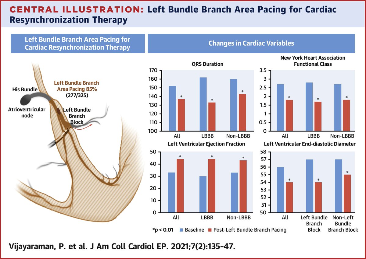 JACCJournals's tweet image. New in #JACCCEP: #LBBAP is a feasible &amp;amp; safe alternative for #CRT w/ low &amp;amp; stable thresholds w/ improved NYHA class &amp;amp; #echocardiogram outcomes. 

Read more about this multicenter, international study from @HisDoc1 &amp;amp; Marek_Jastrz_EP et al. here: bit.ly/2NcJn6T #ACCIntl