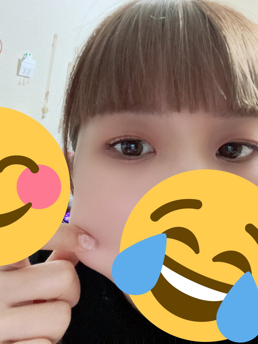 Uzivatel Hika Na Twitteru 最近頬の下あたりの贅肉邪魔すぎて仕事でポニーテールするけどすんごい嫌だ めっちゃホームベースの顔だよ 肉削り落とす方法はねぇか Uzivatel Hika Na Twitteru 最近頬の下あたりの贅肉邪魔すぎて仕事でポニーテールするけどすんごい嫌だ めっちゃホームベースの顔だよ 肉削り落とす方法はねぇか