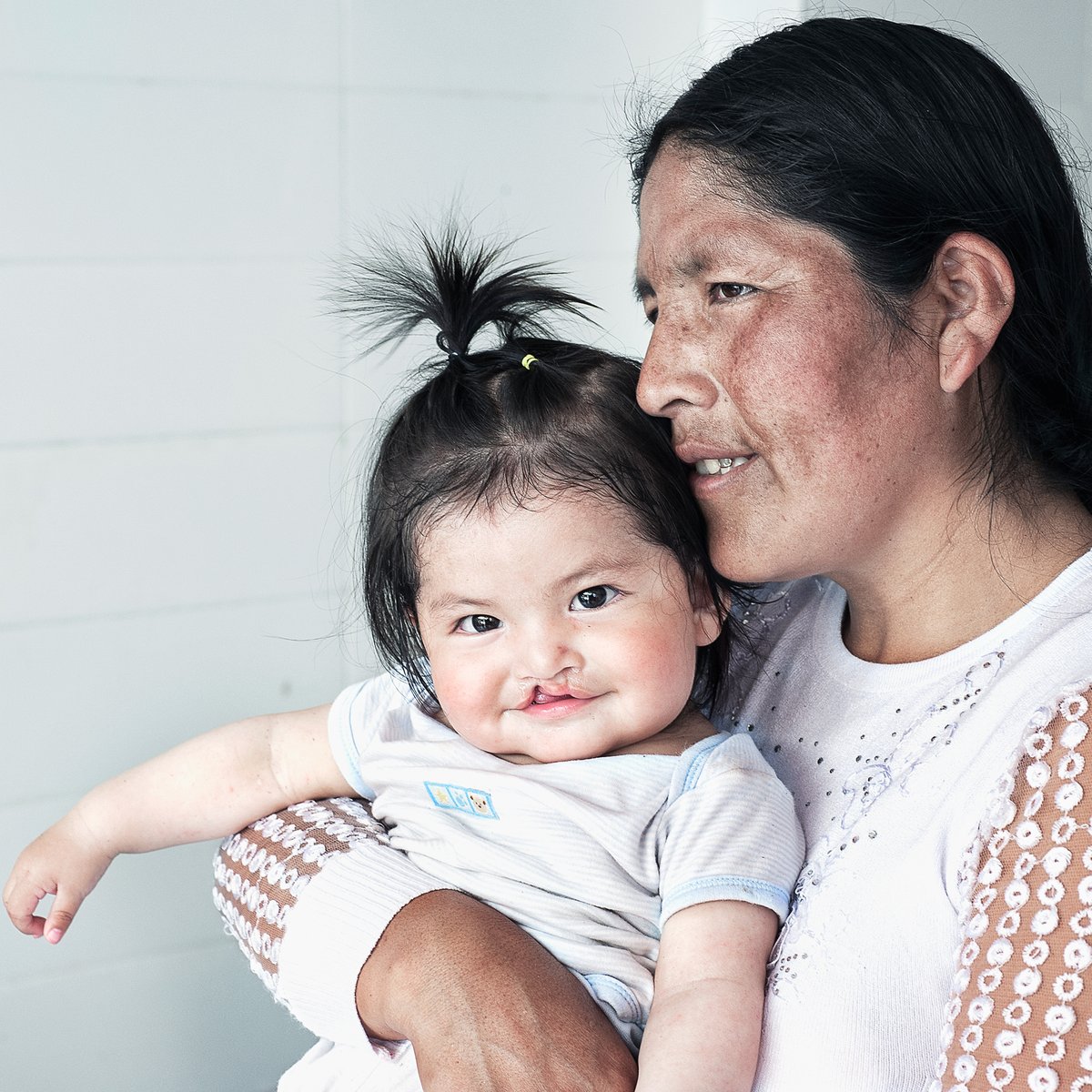 OpSmileCAN's tweet photo. We believe every child born with a cleft lip or cleft palate deserves exceptional surgical care. This belief is what drives our promise – no child who needs us will ever be left behind.
https://t.co/Ukn5Emlm6z
#HelpAChildSmile #CleftCondition #Cleft #ForeverSmiles #Smiles https://t.co/9mDn5a4tvq