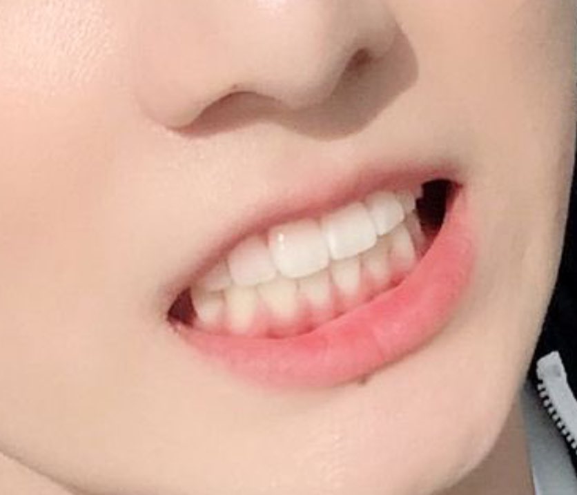 close_ooo's tweet image. โอ้ยยยยยโลกจะแตกเพราะความน่ารักของจองกุกนี่แหละㅠㅠㅠㅠㅠ