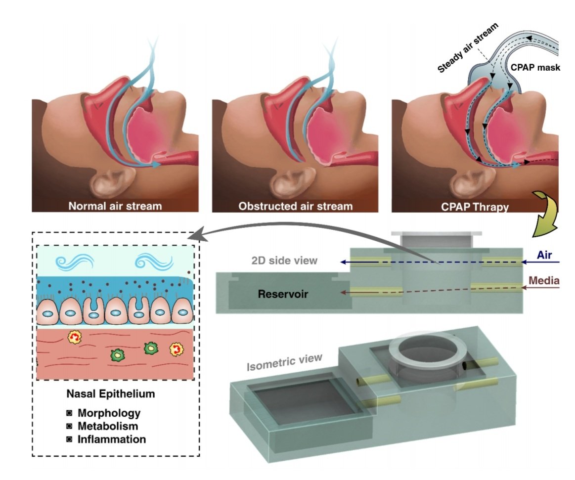 Check our new publication modelling the Obstructive Sleep Apnoea disorder using 3D printing and Microfluidics ❤
@warkianilab
@drjesusshrestha
@CentenaryInst
@3dprintindustry
@OrganOnAChip
@nhmrc
@UTSEngage
@UTSResearch
@UTSFEIT
iopscience.iop.org/article/10.108…