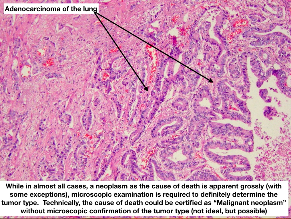  #MTPathUnknown #200 B (4/12)Explanatory slide @Mi79451145  @NW_8408  @AhemdDr  @bhardwaj_swat  @Veggiecupcakes1  @dwnbird Good ID!