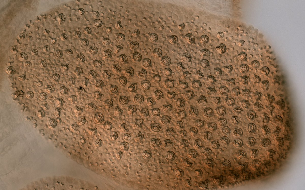 planktomancer's tweet image. Siphonophore tentilla display a wide diversity of shapes 
 and sizes. We found that shifts in diet are associated with changes in the state, mode of evolution, and internal correlations of tentilla &amp;amp; nematocyst morphologies. #SiphWeb